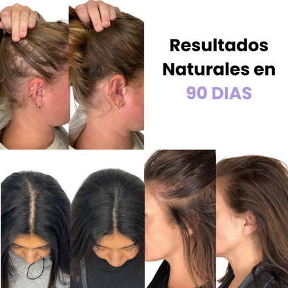 NutriBrush Pro™ | Cepillo de crecimiento capilar